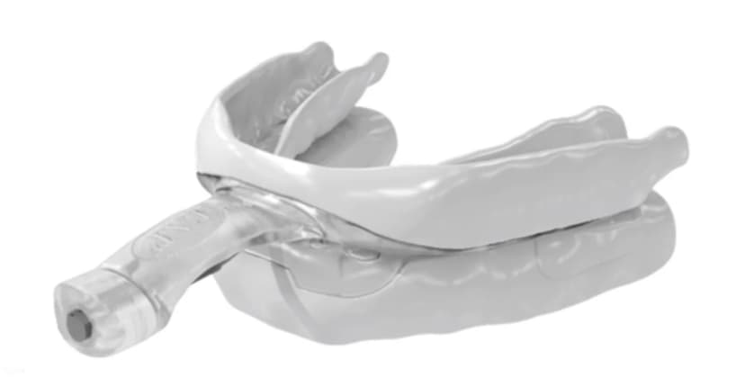 Best Anti-Snoring Mouthpieces and Mouthguards - Best for Back Sleepers - Airway Management myTAP Oral Appliance